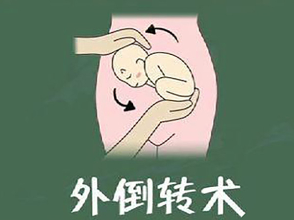 28周胎儿臀位有这五种方法纠正，外倒转术并非首选