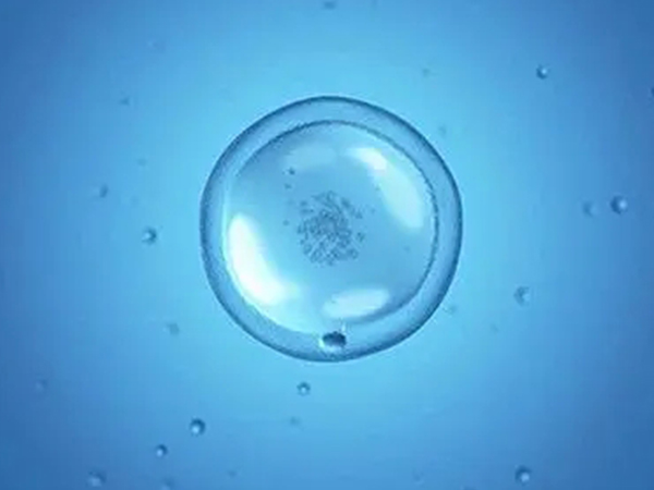 这三大原因都会引起促卵泡刺激素高，笃定卵巢有问题太过片面