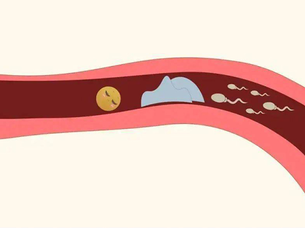 输卵管疏通手术全过程分五步，每个步骤都很重要