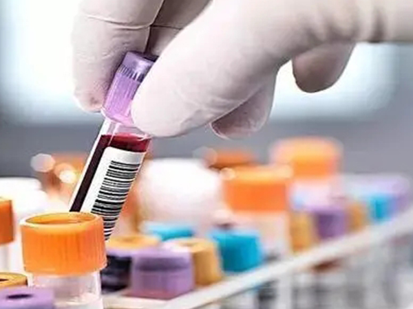 怀孕小知识：各阶段hcg正常值对照表新鲜出炉