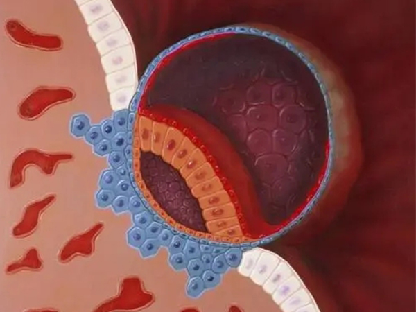 试管前三个月前请尽量卧床，做好准备工作着床更轻松