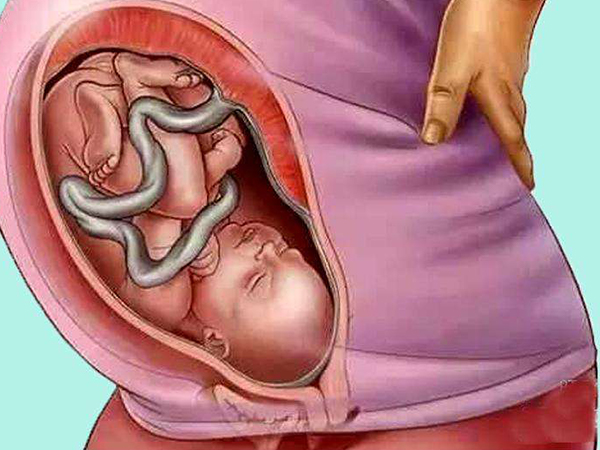 孕妇胎盘低时得注意这五个方面，不卧床休息努力白费