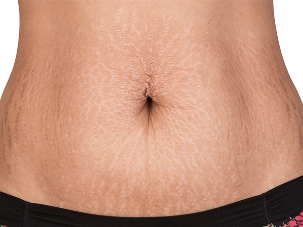 产后子宫收缩好有这三大表现，从恶露看恢复情况不要太方便