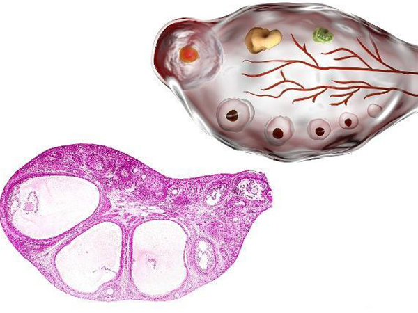 促排卵成功后并非一定能受孕，这四大原因成生育新阻碍