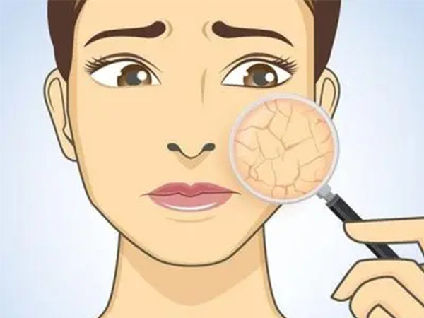 教你三招缓解绝经后皮肤干燥，这些食物保养效果不要太强