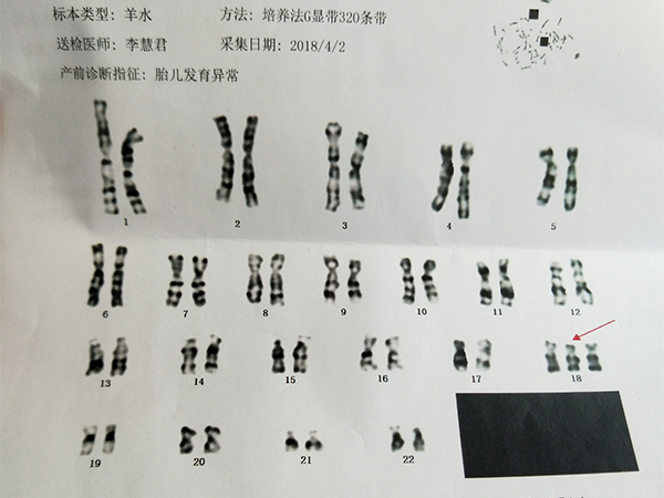 哪有“第一胎就胎停很常见”的说法，这四大原因才是停育元凶