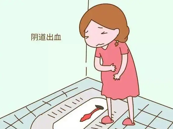 绝经后的出血也有良恶性之分，这四种情况均不能判断为癌