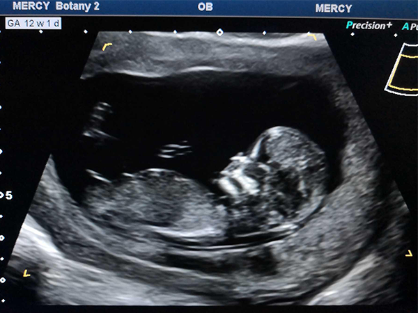 nt图弯着就是男孩！这些nt看男女诀窍建议收藏