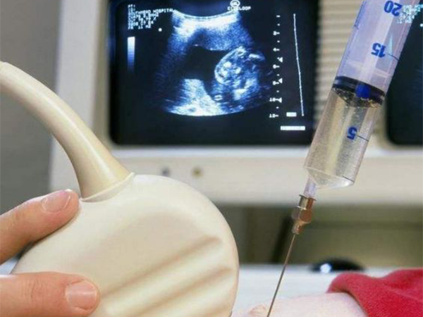 妇科熟人都不建议做羊水穿刺，清楚这些危害对你有好处