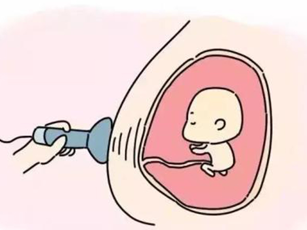 唐筛100个人只能通过十个？揭秘通过率低的三大原因