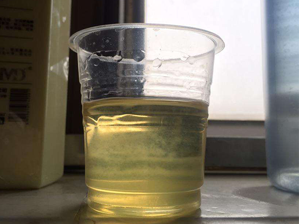 已生男宝妈妈的经验之谈，晨尿加酒精测男女步骤详解