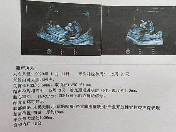 nt厚度越薄越聪明？这才是关于nt值的正确解读