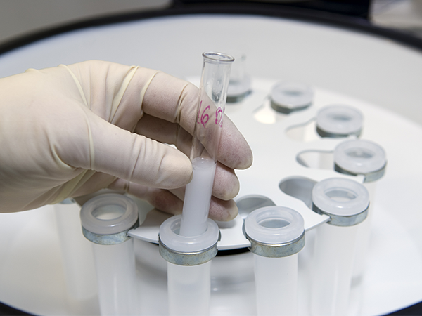 揭秘精子库中冷冻精子的存活时间，冷冻8年还能用