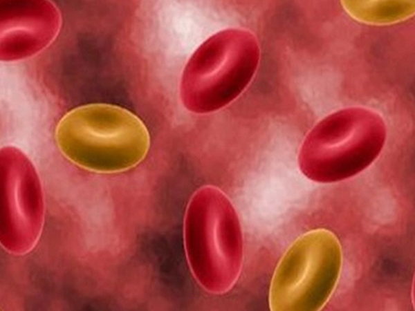 o型血女性忌生二胎不是谣传，沾染上溶血症真的很麻烦