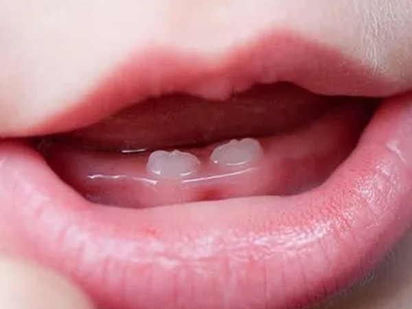 宝宝只吃安抚奶嘴不吃奶？除了厌奶期还有还有这些原因