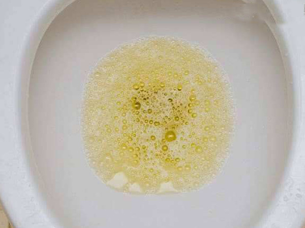 白醋和晨尿测没反应？想起泡泡就得按照正确步骤来