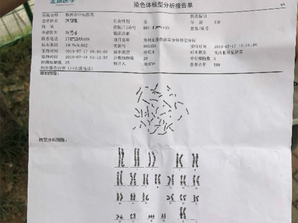 18三体值看胎儿性别的四种方法，为负数时明显是男孩