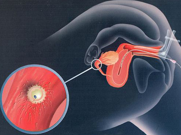 人授第五天成功怀孕了！这些顺利着床的表现要把握住