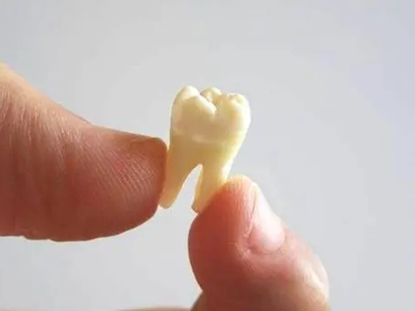 记住儿童换牙顺序和时间真不难，一张图就让你读懂！