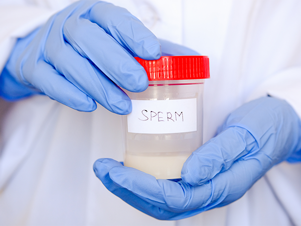 胎停育和男方精子质量息息相关，这两项检查必做！
