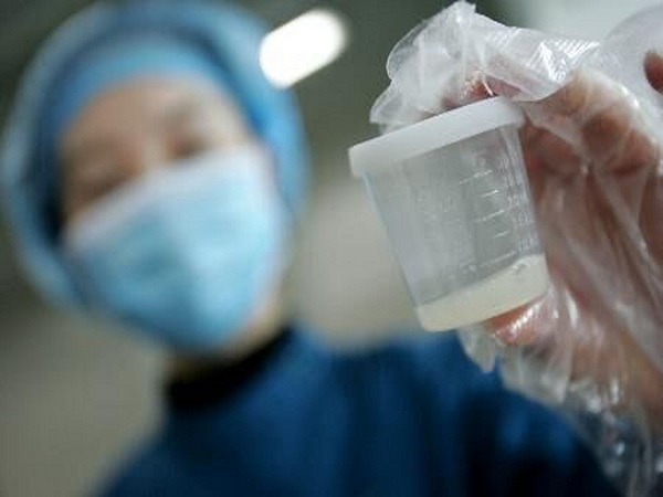 男性xy精子的区别可不小，外表形态、存活时间大不同