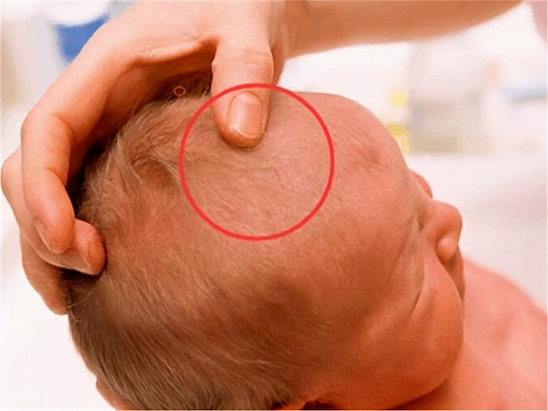 囟门闭合晚对宝宝有影响，这3大危害家长不容忽视