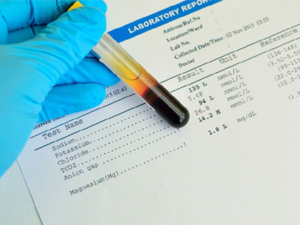 解读试管促排期间激素标准：雌激素血值低于这个数要当心