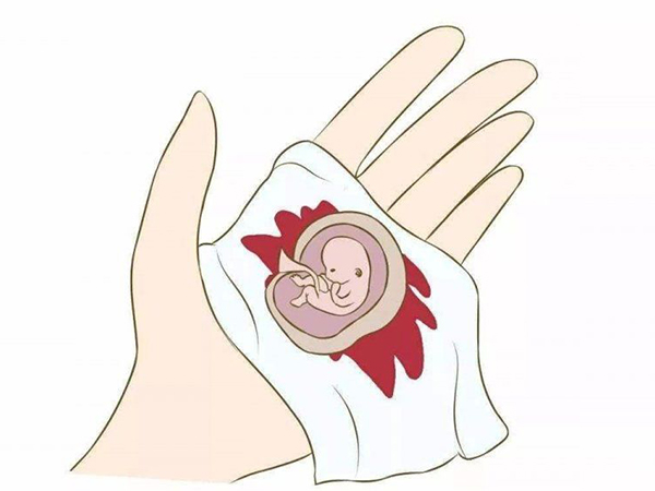 孕早期先兆流产血的颜色有三种，教你通过颜色深浅确定保胎几率