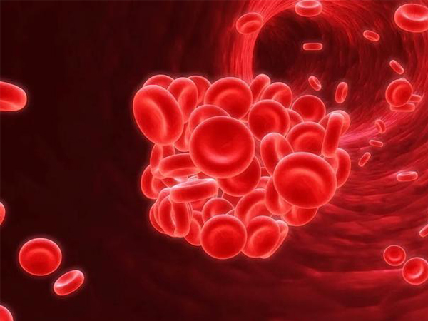 新生儿abo溶血性黄疸的三大特征分析，皮肤黄染是典型症状