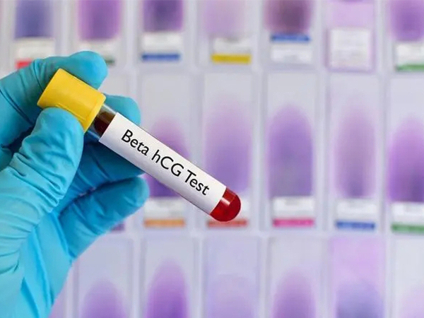 早孕6周hcg看男女最准不科学，这些民间看性别方法均不可信