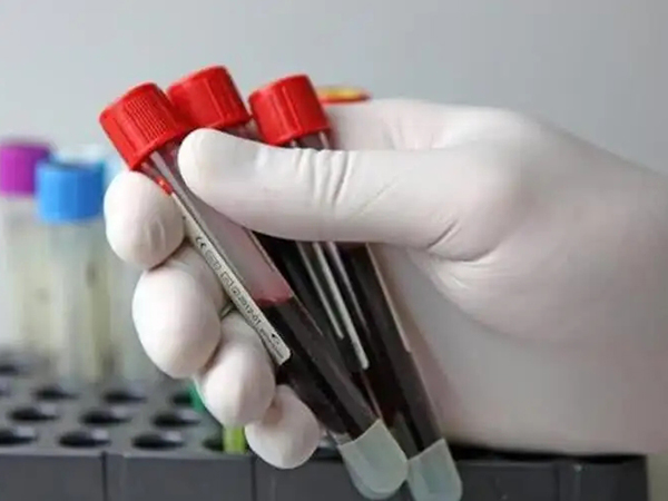 世界上最稀有的十大血型汇总：排名第一的竟不是熊猫血！