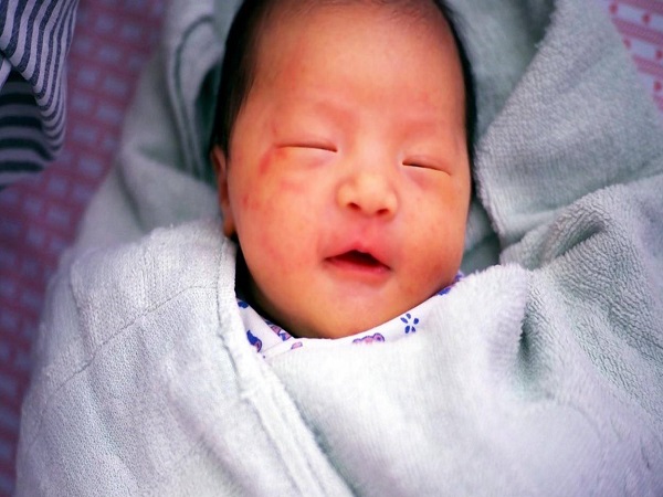 婴儿30天黄疸值对照表分享：只要不高于正常值就别担心