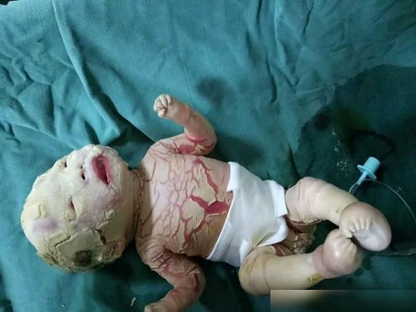 如懿传中火棉胶婴儿图片分享：外表神似外星人不适者慎入