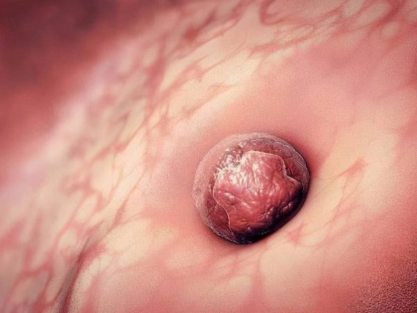 着床成功排出的白带图片参考：出现水样液体是受孕的迹象