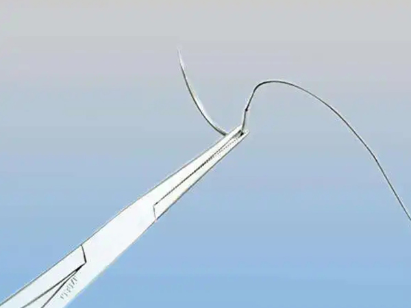 顺产侧切线头不吸收鼓包真实图分享，红肿、化脓不适者慎看