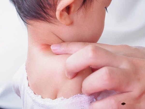 婴儿冬天捂热的疹子真实图片分享，身上有红点就要注意了