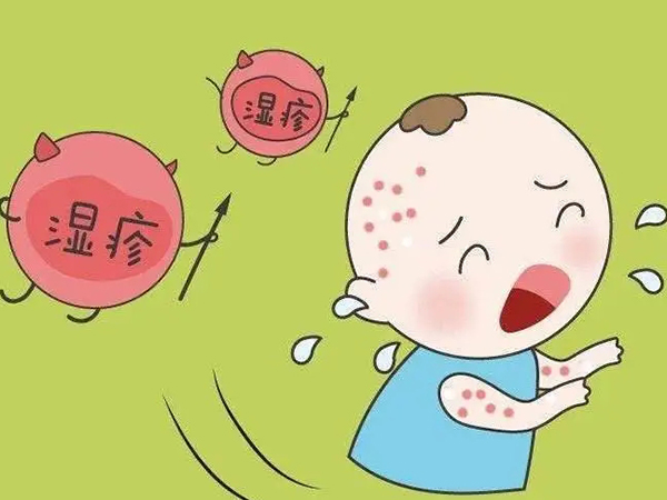 新生儿无激素湿疹药膏十大牌子排行榜：认准一款足矣！