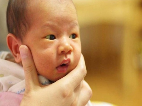 三种黄疸粪便的颜色鉴别诊断，黄绿色是好转的前兆别担心