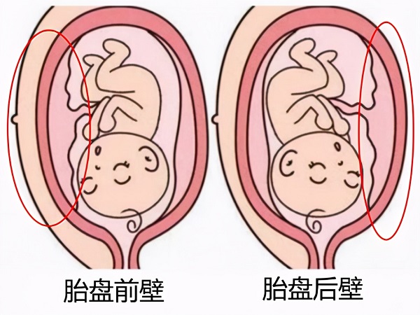 怀孕前壁和后壁看男女有技巧，准不准看性别概率你就知道