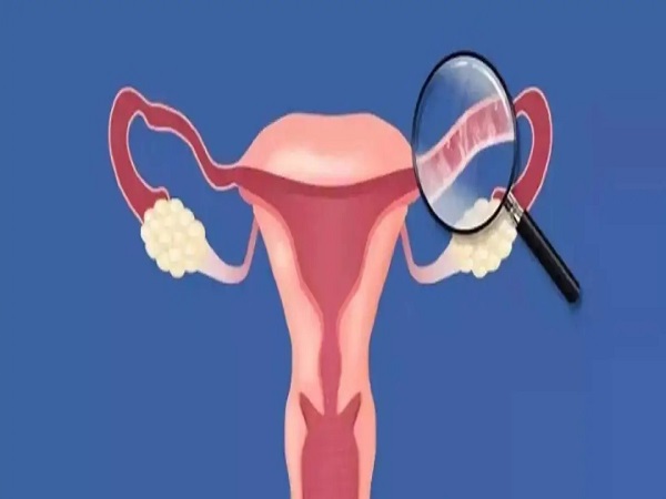 小手指自测输卵管通畅的方法分享，误差大准确率有待商榷