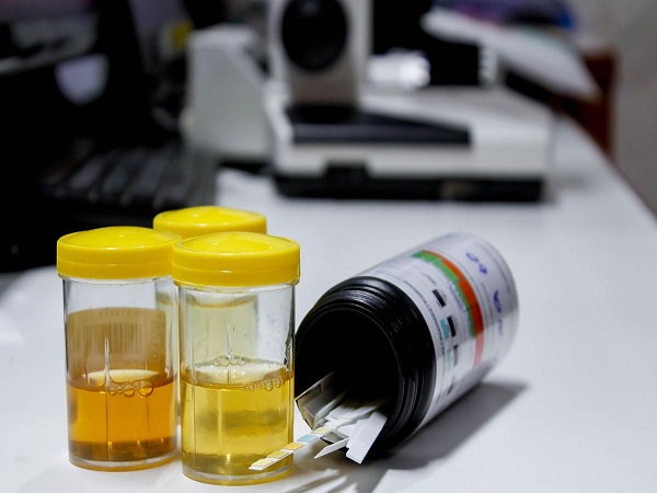 已生男宝的过来人告诉你，尿ph值7.0一定是男孩真的不可信！