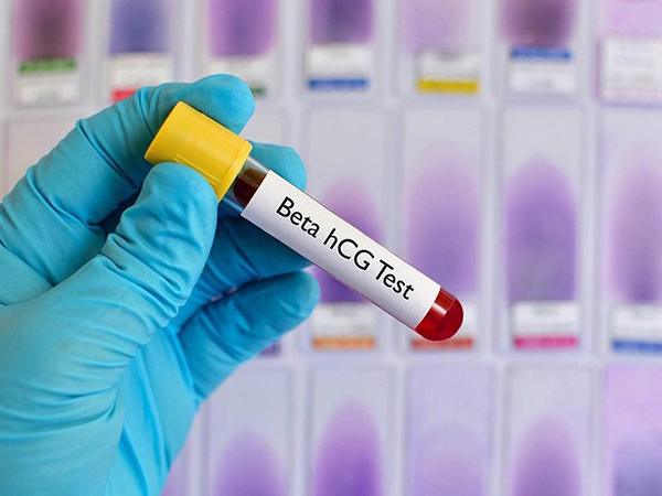 怀孕千万不要频繁查孕酮和hcg，过度检查没意义还会增加焦虑