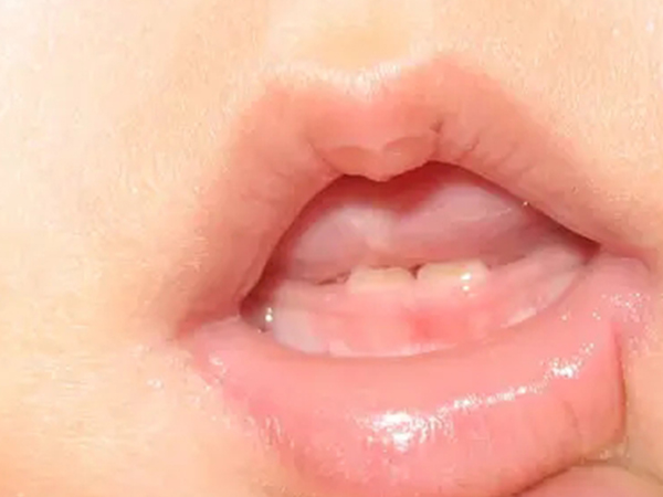 孩子单出牙的民间说法大集合：命运坎坷是迷信真不要信！