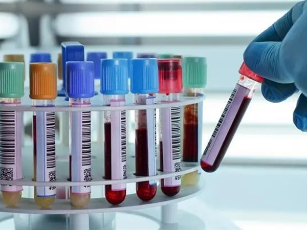 卵泡成熟抽血看三项激素有标准：数值是否达标是关键