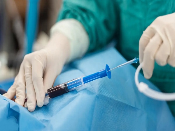 不建议孕妇做羊水穿刺和体质有关系，哪些人不适合要弄清