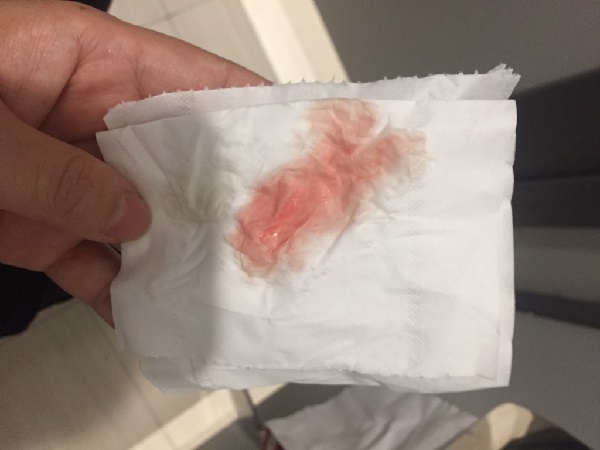 孕妇卧床保胎休息最佳姿势图，除平躺外这些对胎儿也有利