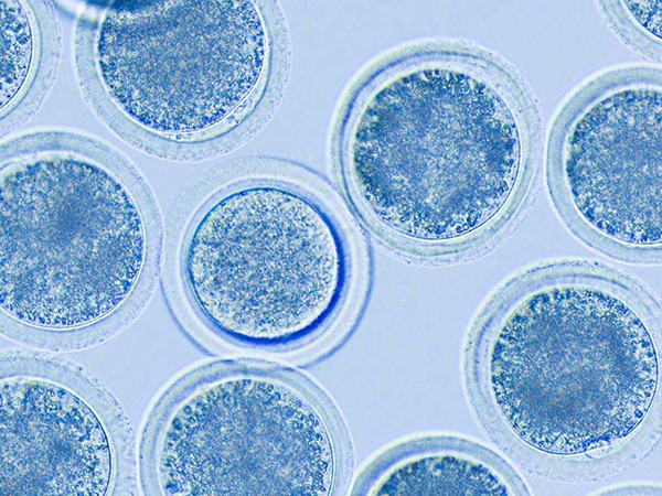 月经14天卵泡大小有标准，看参照表一秒就知是否正常