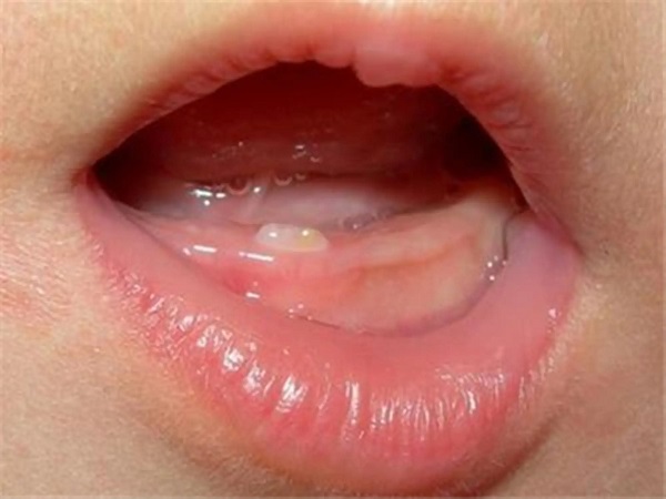 宝宝四个月出牙齿的民间说法，长牙早不吉利是迷信不要信！