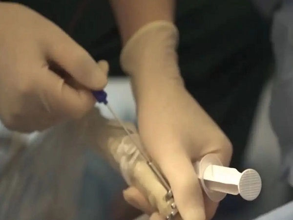 图文详解取卵针取卵手术全过程，4个步骤真没想象中可怕