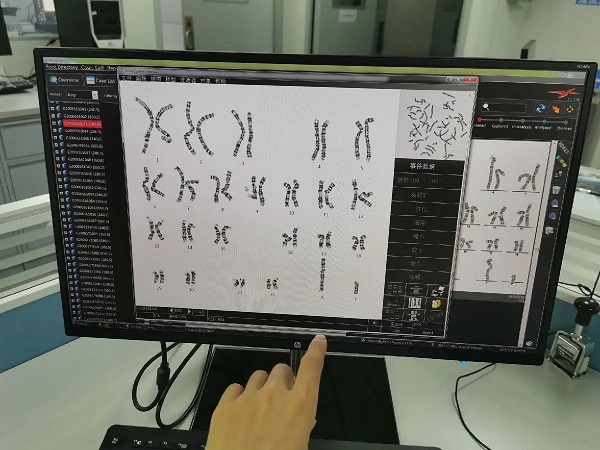 正常人也会染色体异常有原因，没表现出来不代表你没有！